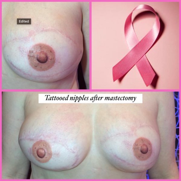 Scar coverup breasts